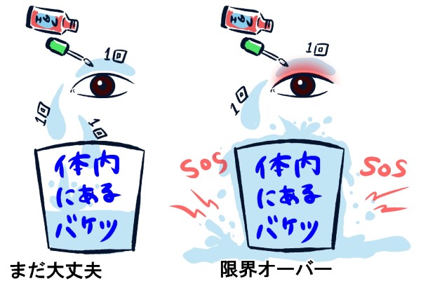 アイプチかぶれ奮闘記B化粧品系のアレルギーを疑い検査する
