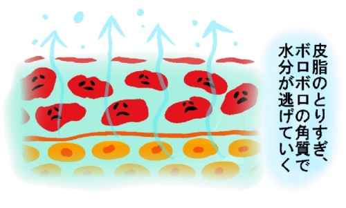 �n��A���T�[,���e,���N,���̎q,�_�C�G�b�g,����