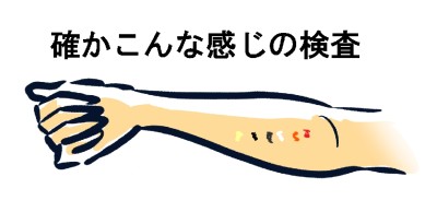 アイプチかぶれ奮闘記B化粧品系のアレルギーを疑い検査する