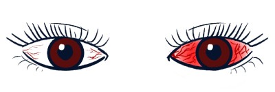 �n��A���T�[,���e,���N,���̎q,�_�C�G�b�g,����