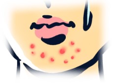 貧弱アラサー,美容,健康,女の子,ダイエット,美肌