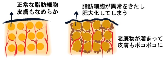 貧弱アラサー,美容,健康,女の子,ダイエット,美肌